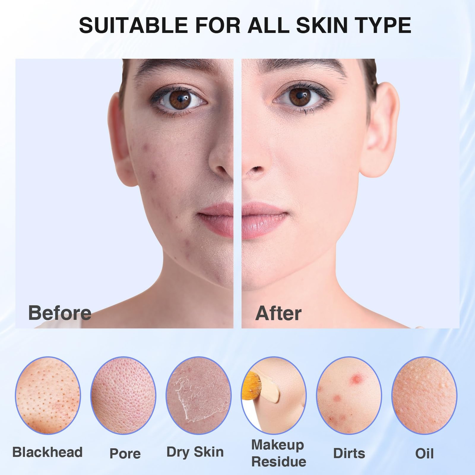 5 Modes Silicone Face Scrubber, Waterproof Face Scrubber Exfoliator for Men & Wo
