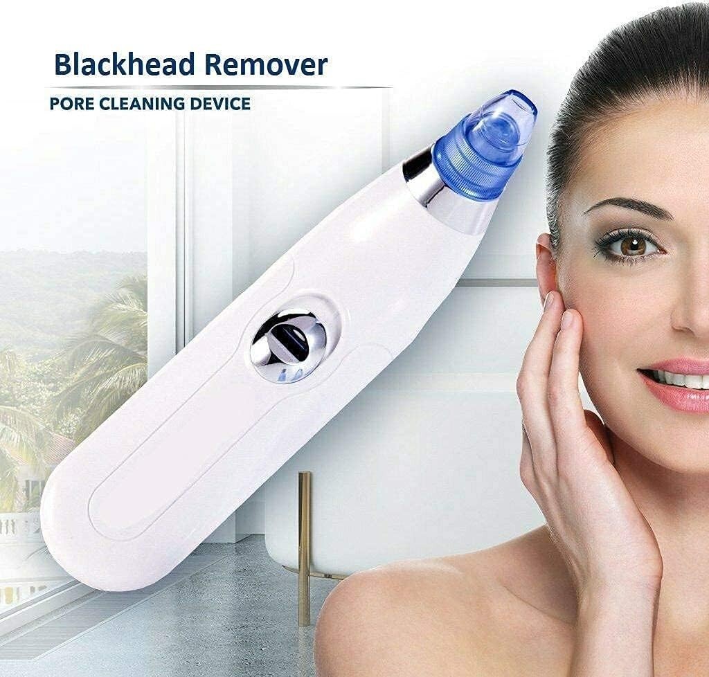 4-in-1 Electric Blackhead Remover Pore Vacuum Suction | Face Cleaner | FS USA