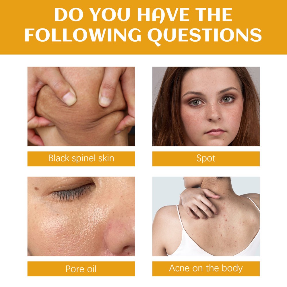 Spot Cleanser Deep Cleansing Facial Body Skin Fade Spot