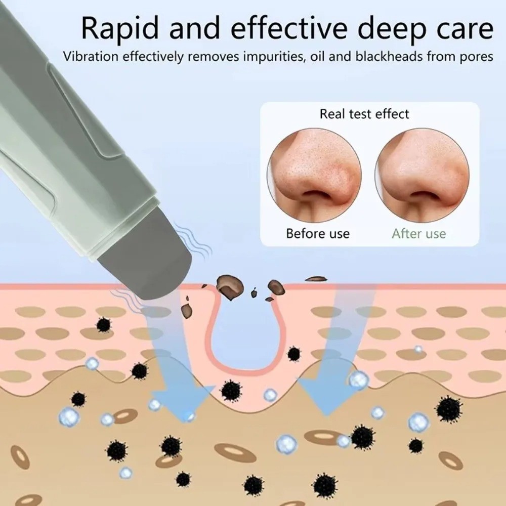 Ergonomic Blackhead Remover Spatula for Pore Facial Cleansing&Daily Face Washing