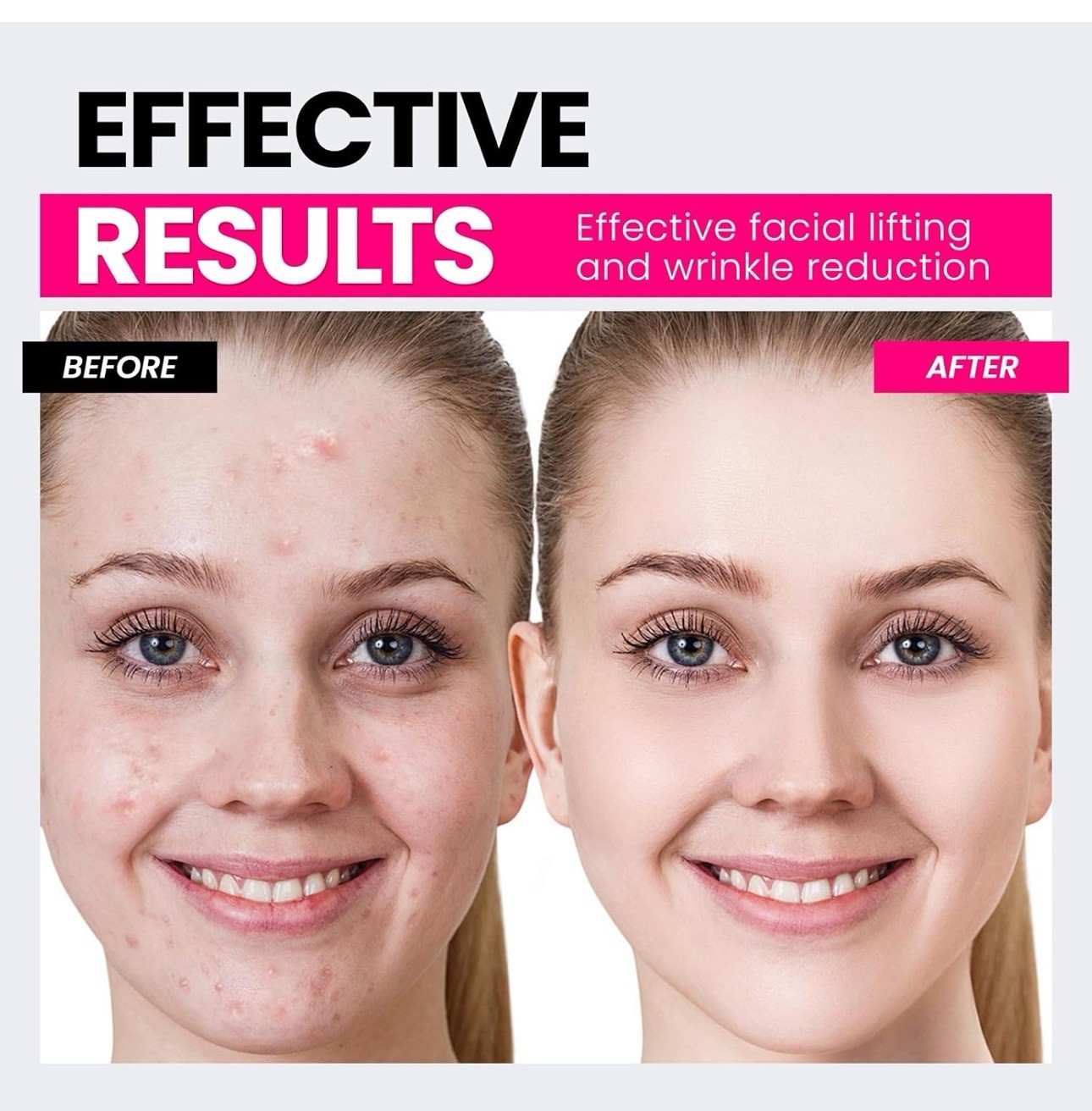 Microcurrent Facial Device with Red Light – Lifts, Firms & Smooths Skin