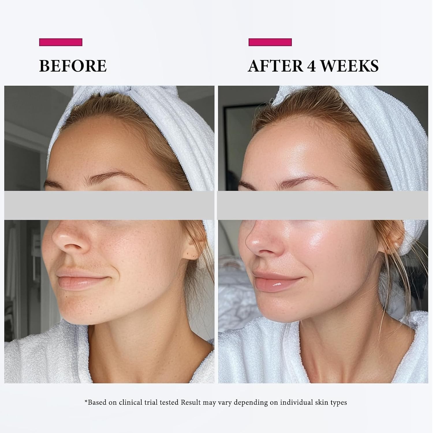 Professional Nano Ionic Face Steamer – Effective for All Skin Types & Relaxation