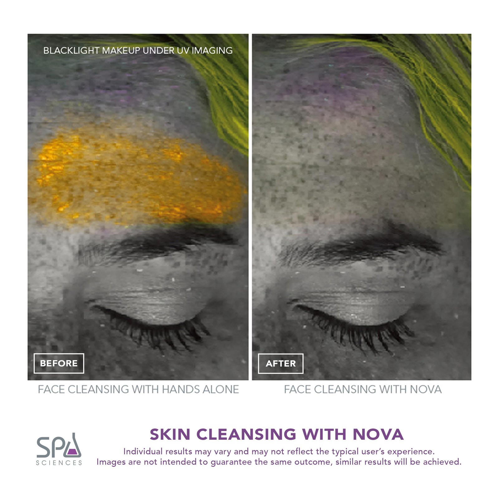Spa Sciences – Nova – Sonic Cleansing Brush Bristles Infusion System Anti-Aging