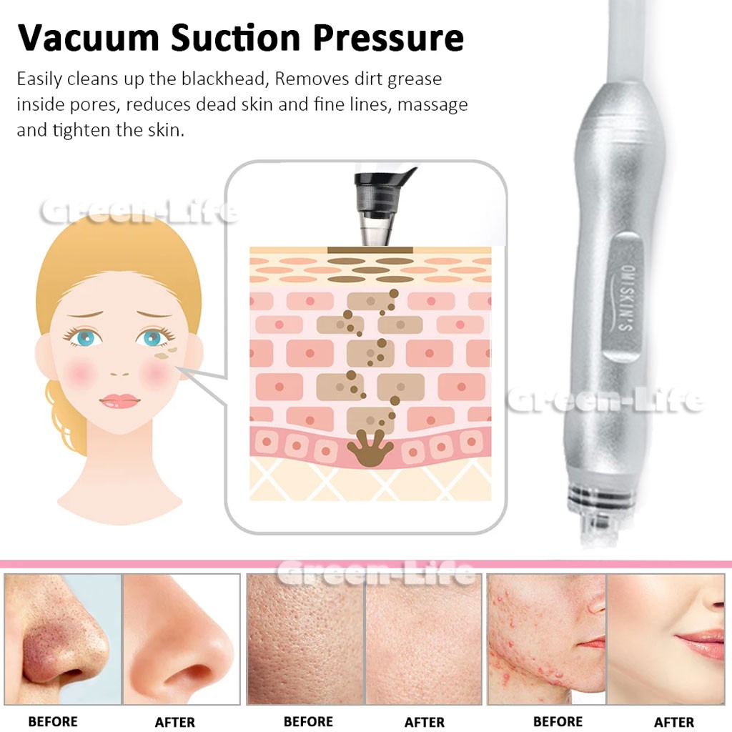 Vacuum Small Bubble Cleaning Blackhead Acne Beauty Device Oxygen Bubble Machine