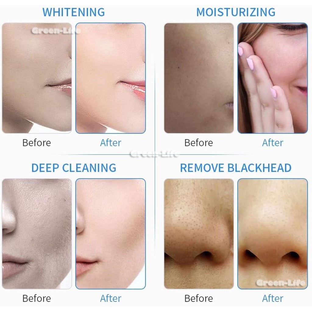 Vacuum Small Bubble Cleaning Blackhead Acne Beauty Device Oxygen Bubble Machine