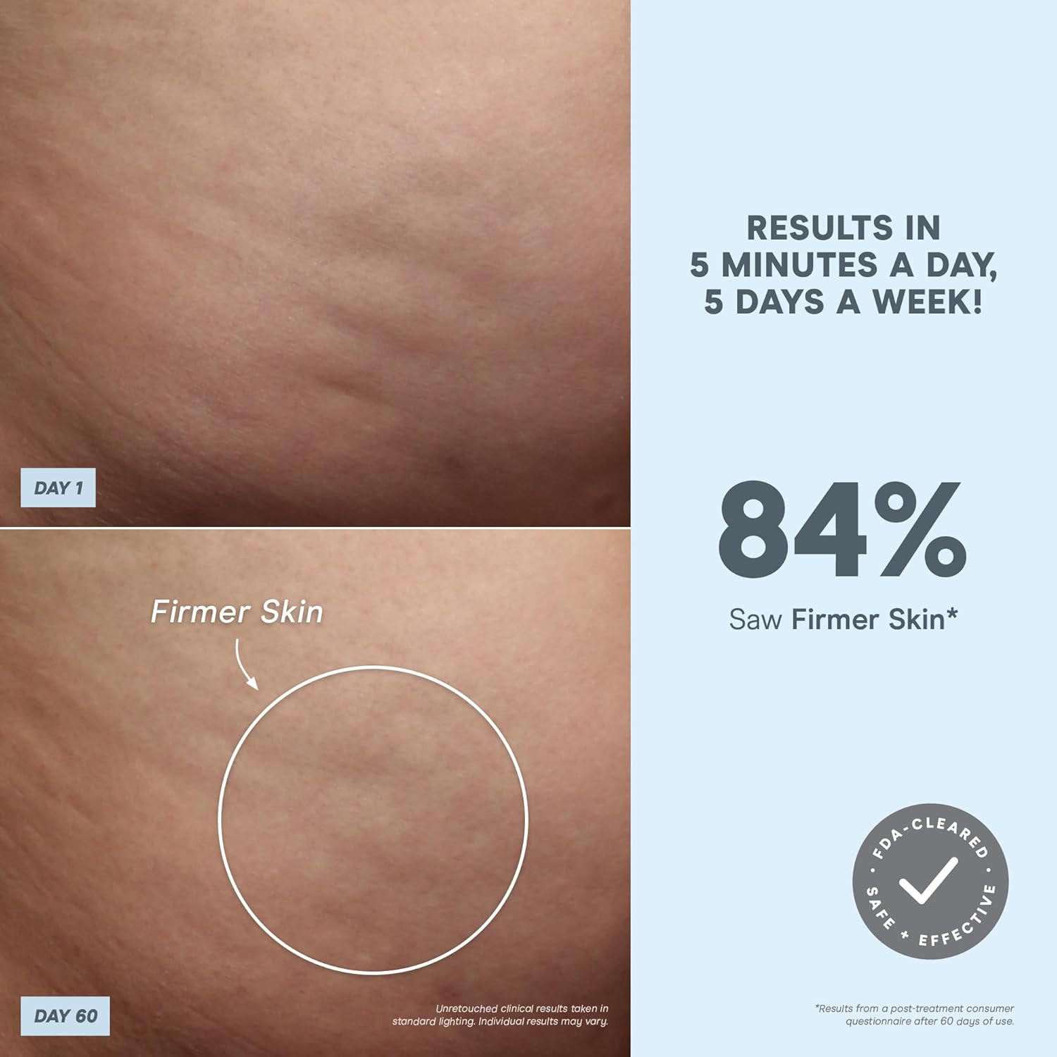 Nubody Toning Device – for All-Over Contouring, Firming & Skin Tightening