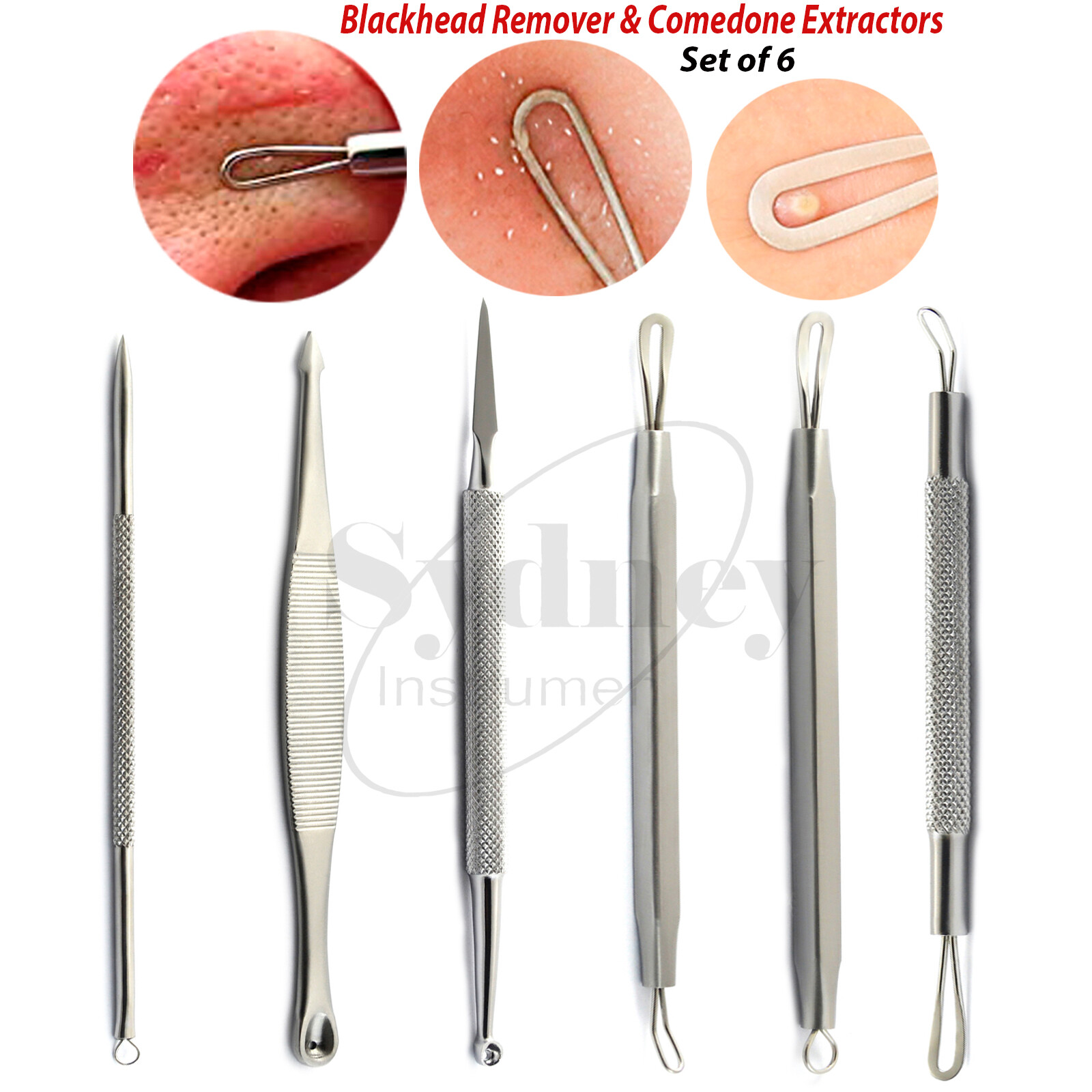 Pimple Blackhead Remover Spot Acne Blemish Comedone Extractor Tool