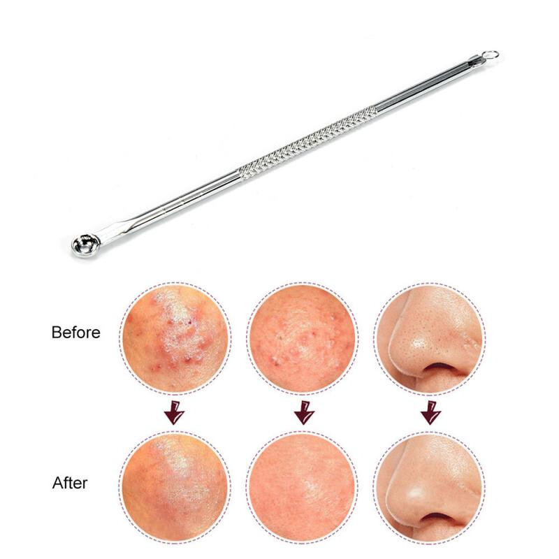 Acne Blackhead Remover Needle Tools Set Pimple Extractor Stainless Steel