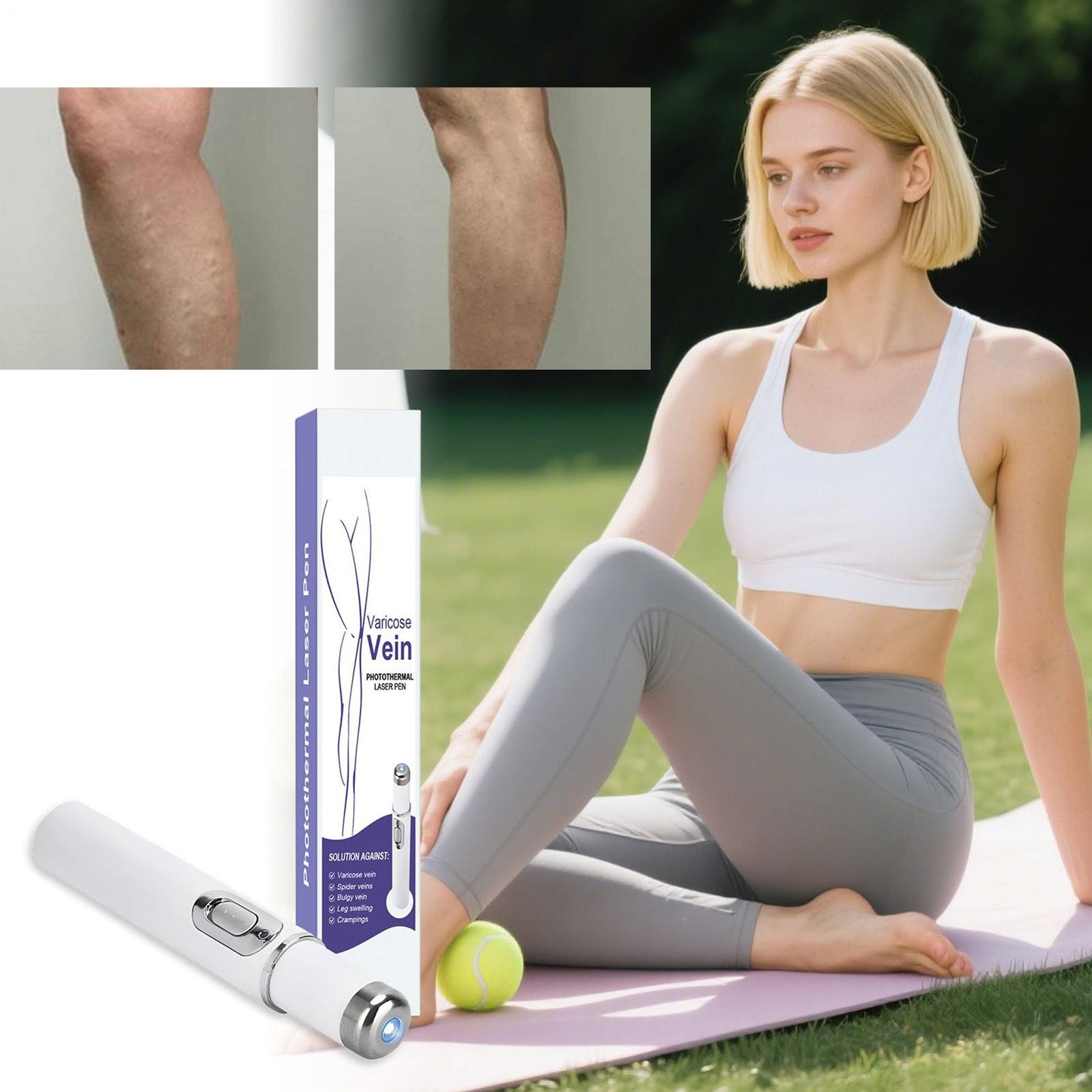 Spider Vein Eraser Skin Tag Remover Pen Wireless Vein Care Pen For Daily Relief