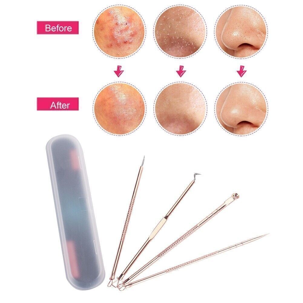 4pcs Blackhead Removal Acne Extractor Blemish Pimple Remover Tool Beauty Needle