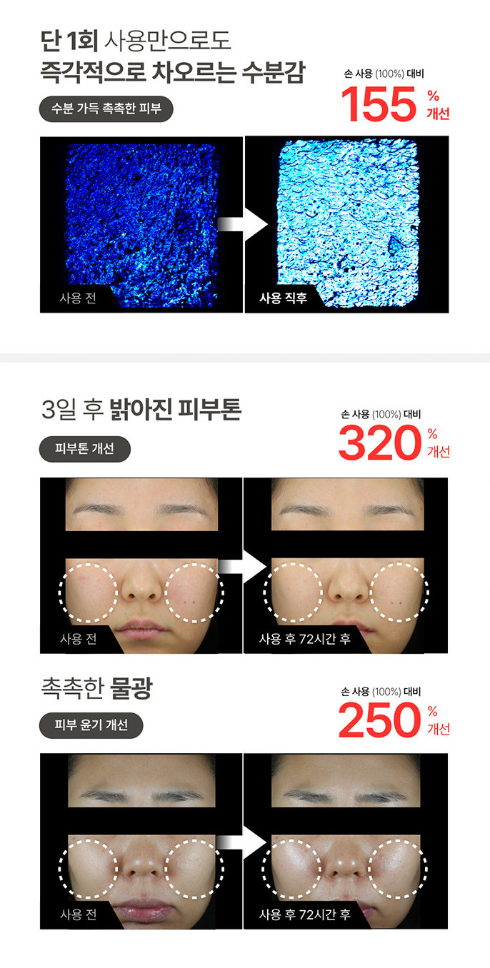 LG Pra.L Skin Booster BBS1 – Facial Device (1 Unit)