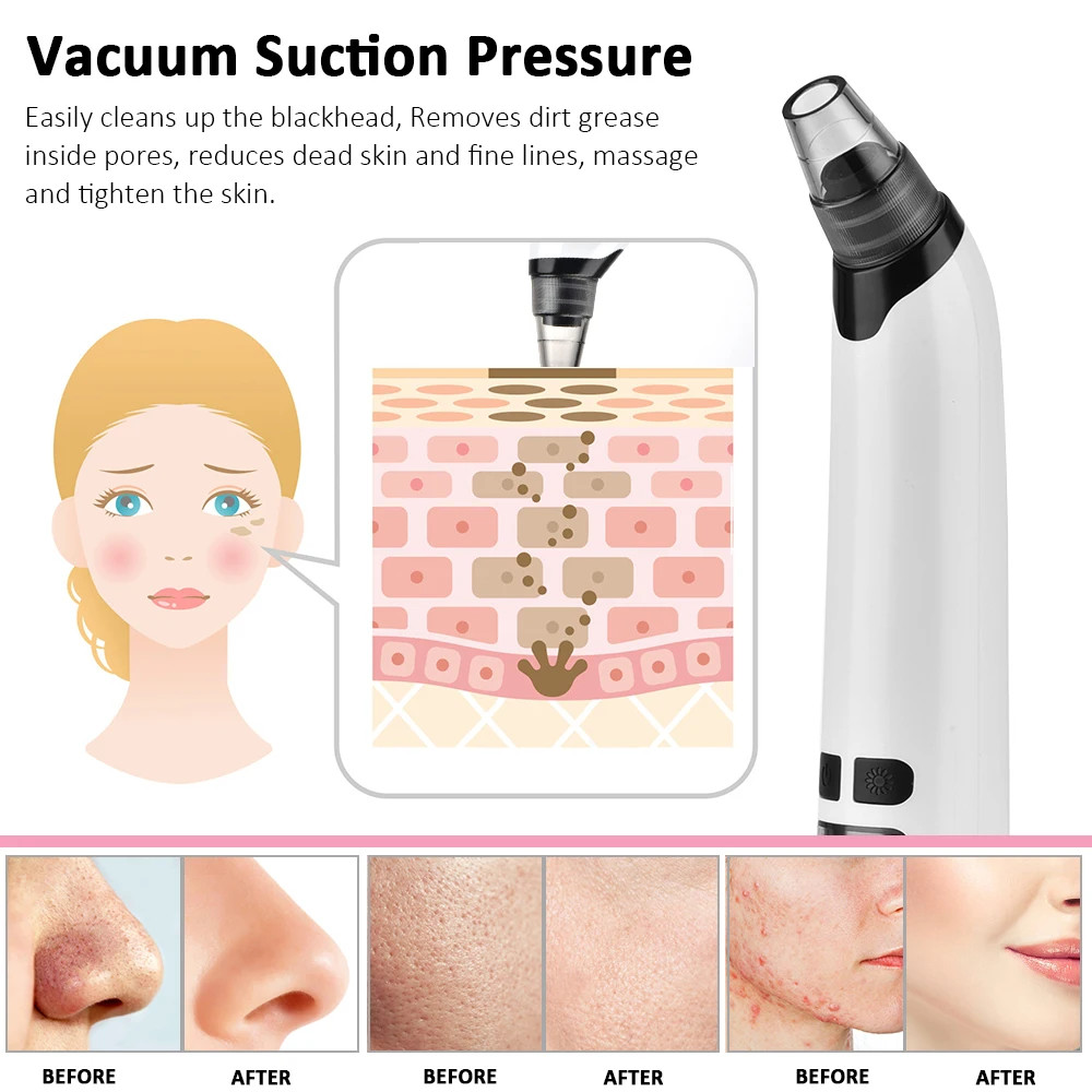 Electric Blackhead Remover Device and Mist Sprayer Face Skin Tester Skin Care Se