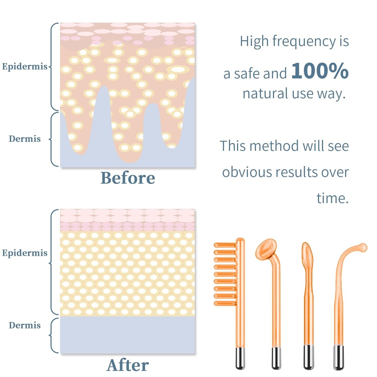 Máquina Facial De Alta Frecuencia, Varita Facial De Alta Frecuencia, Dispositivo