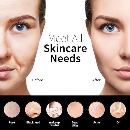 Silicone Facial Cleansing Brush, Rechargeable