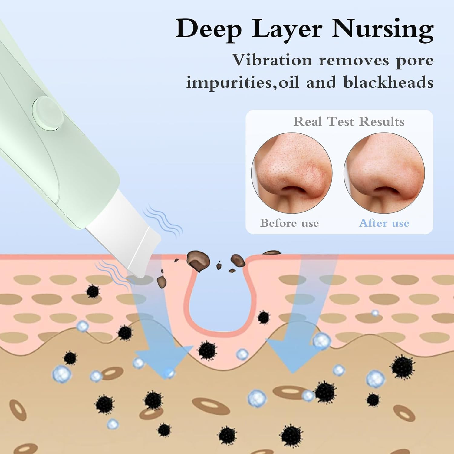 Skin Scrubber Face Spatula Skin Spatula Pore Cleaner Blackhead Remover Tools for