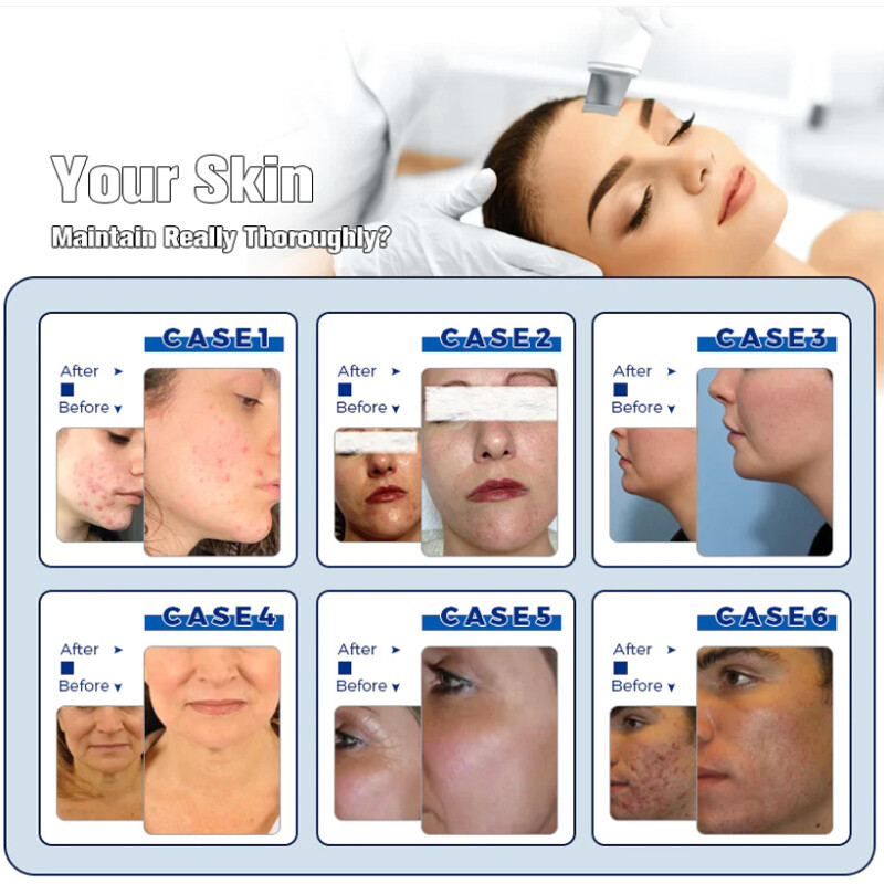 Facial Multifuncional Skin Care Machine Hydra Diamond Peeling Aqua Oxygen Spray