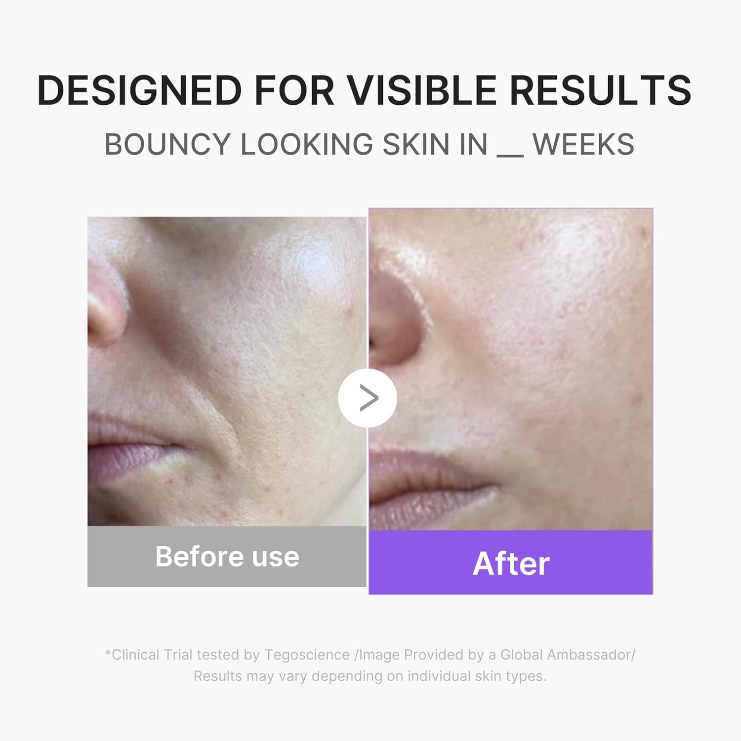 medicube Mini Booster Pro Plus Full Facial Device Set | 3-in-1 Korean Facial Dev