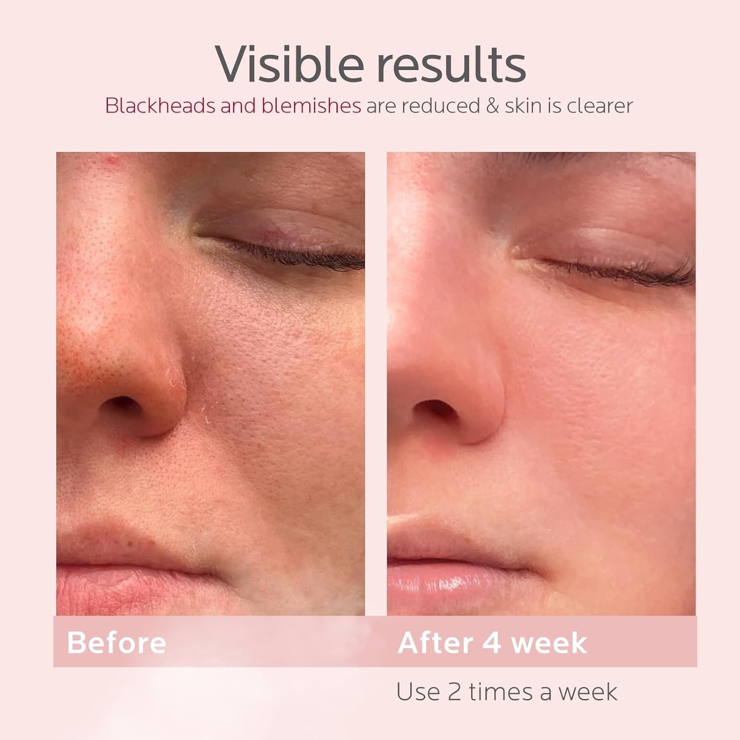 Vaporizador facial para spa en casa regalos de autocuidado para mujeres NUEVO US