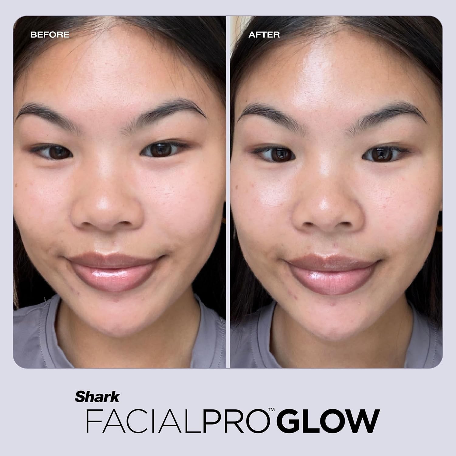 Shark FacialPro Glow at-Home Hydro-Powered Facial System with DePuffi Hot & Cold