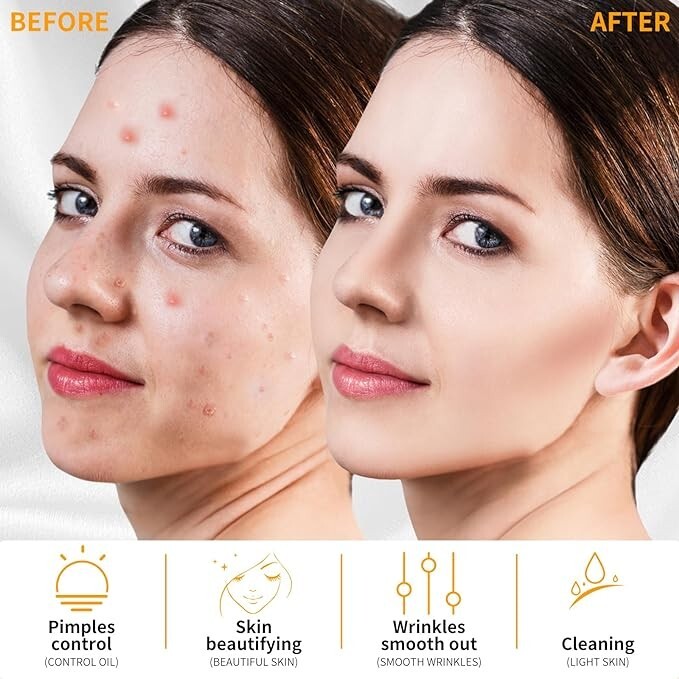 Máquina de varita facial portátil de alta frecuencia para el cuidado de la piel.