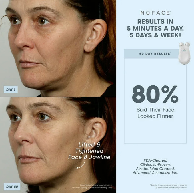 NuFace Trinity Advanced Facial Toning Device Wrinkle Reducer