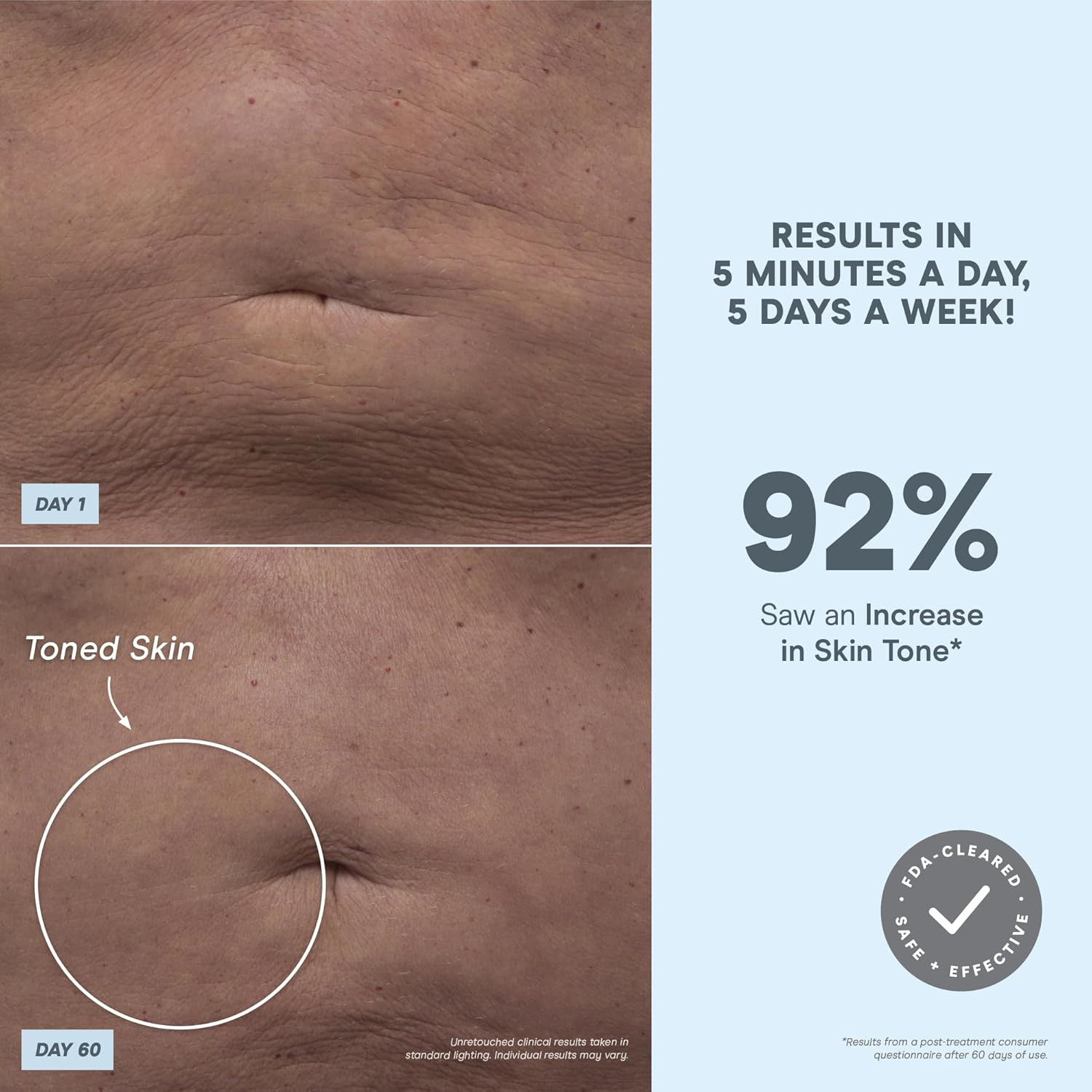 Nubody Toning Device – for All-Over Contouring, Firming & Skin Tightening
