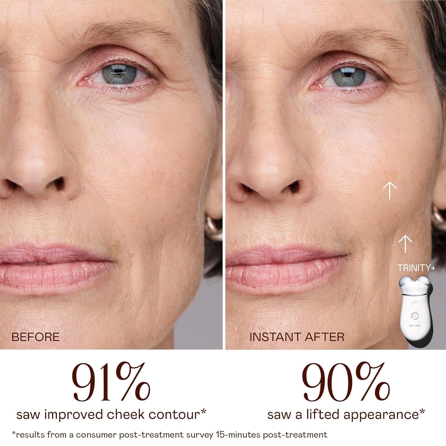 Facial Sculpting Device NUFACE Trinity+ Microcurrent 3 Frequencies