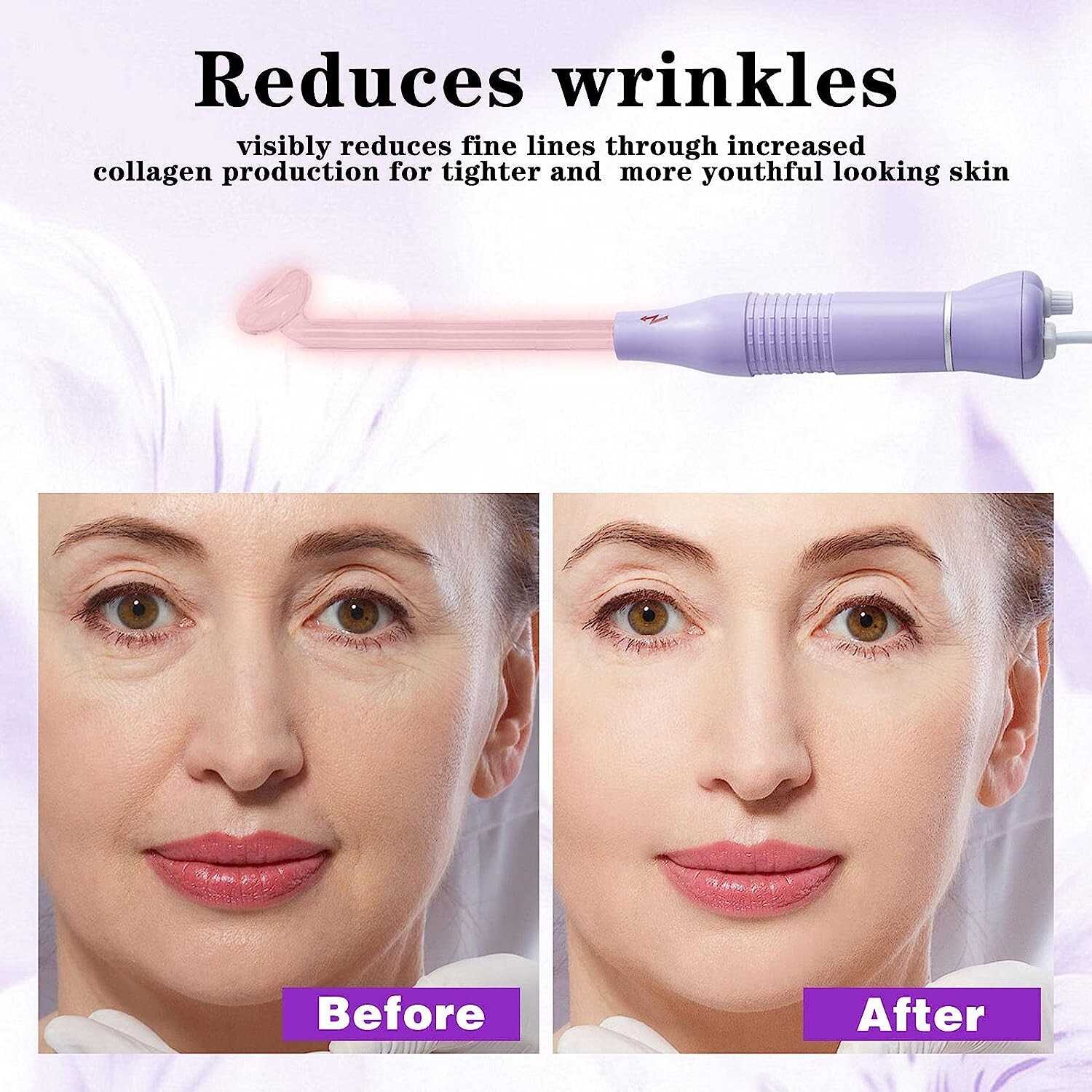 Bvcewilty Facial Tool for Skin Care