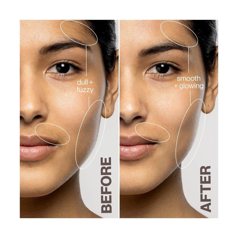DERMAFLASH LUXE+ Device, Anti,Aging, Exfoliation, Hair Removal, and Dermaplan…