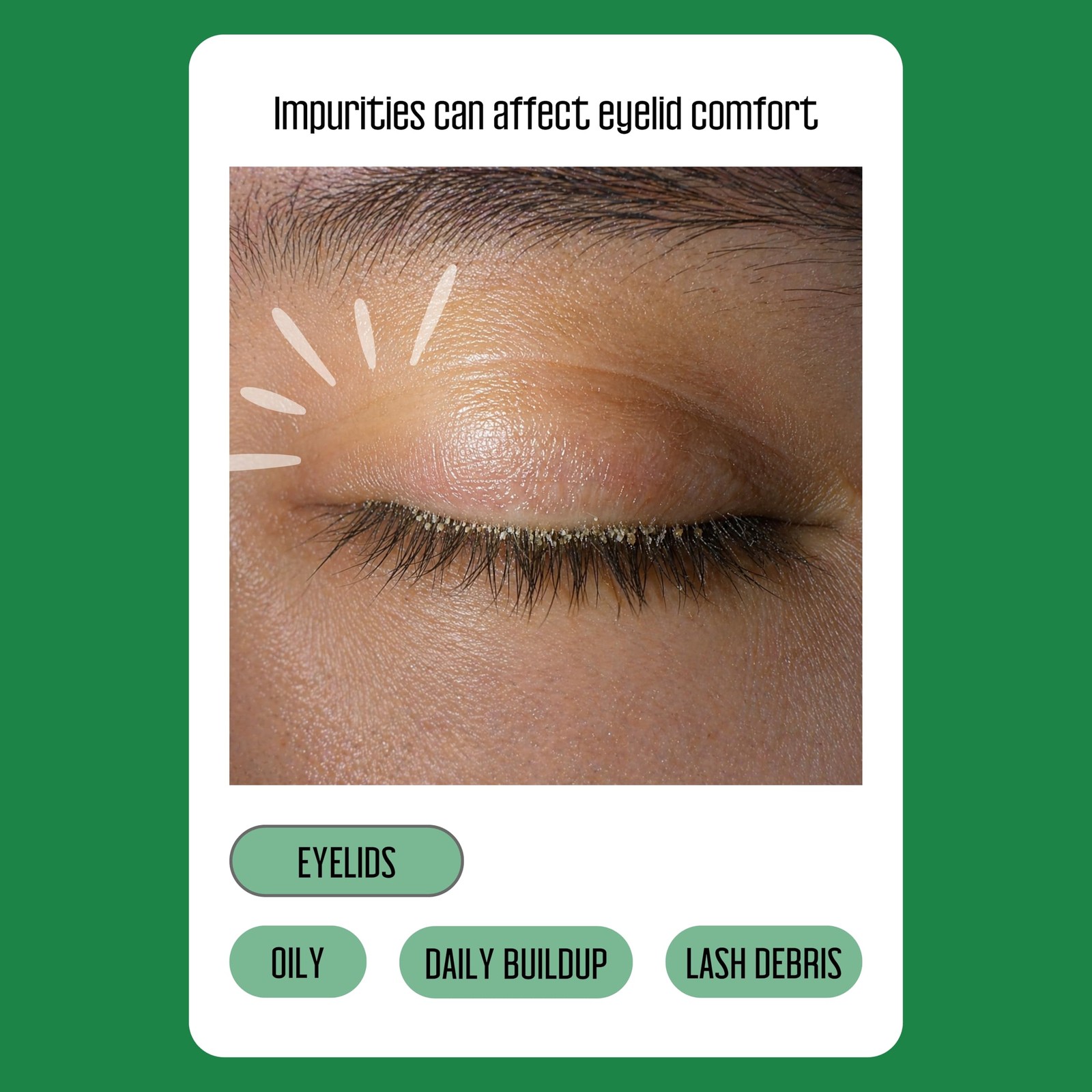 PURELID 100PCs Tea Tree Eyelid Wipes – Cleaning Eye 100 Count (Pack of 1)