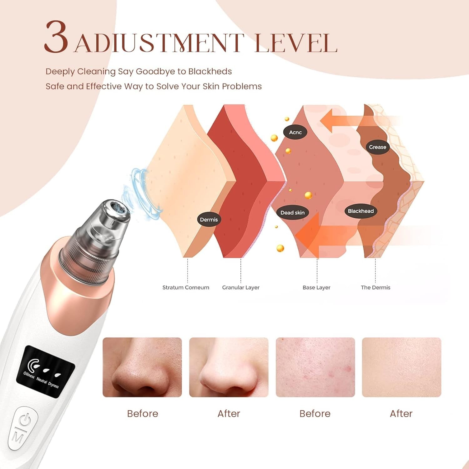 Electric Blackhead Remover Pore Vacuum Suction Diamond Dermabrasion Face Cleaner