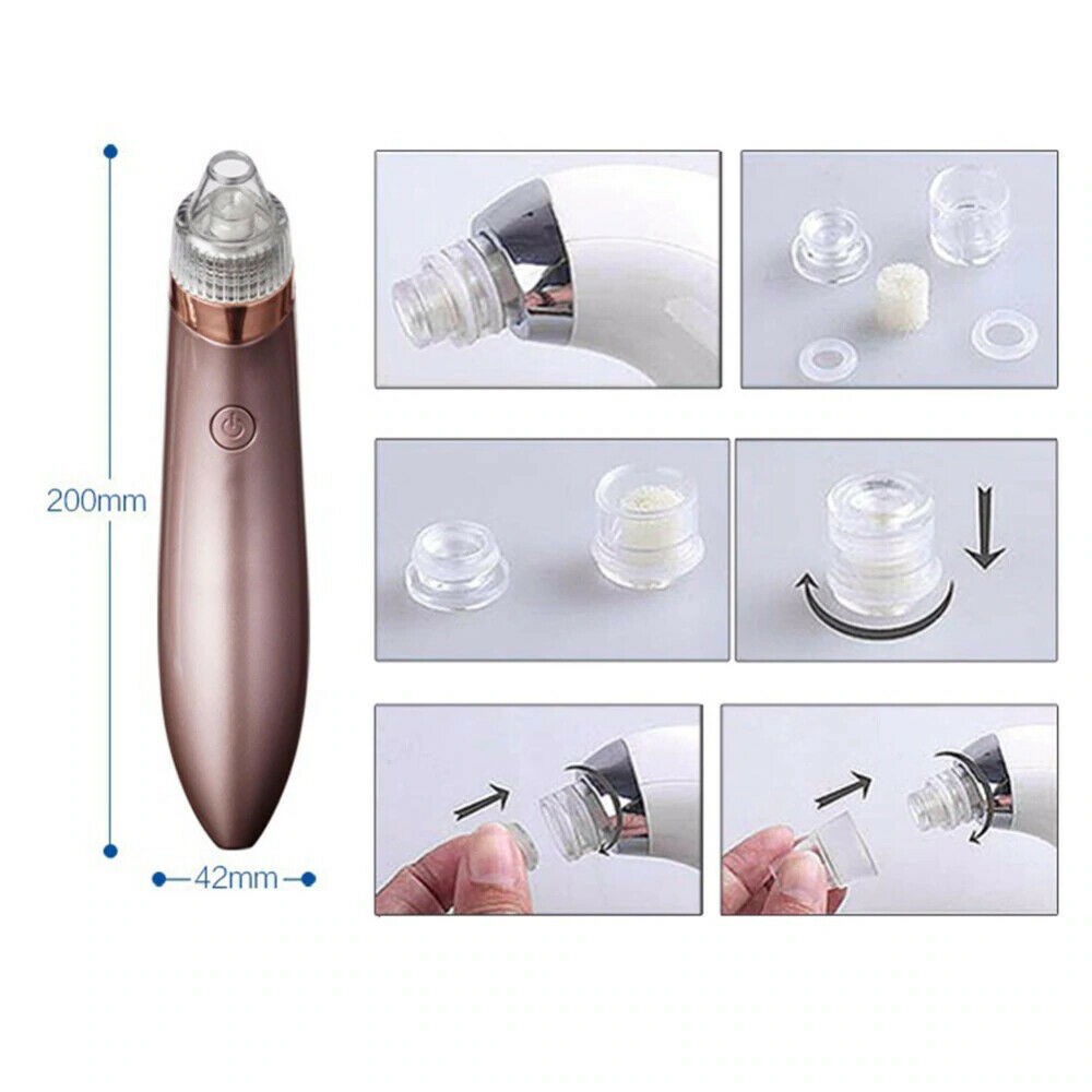 Electric Blackhead Vacuum & Pore Cleaner – Strong Suction, Acne & Pimple Remover