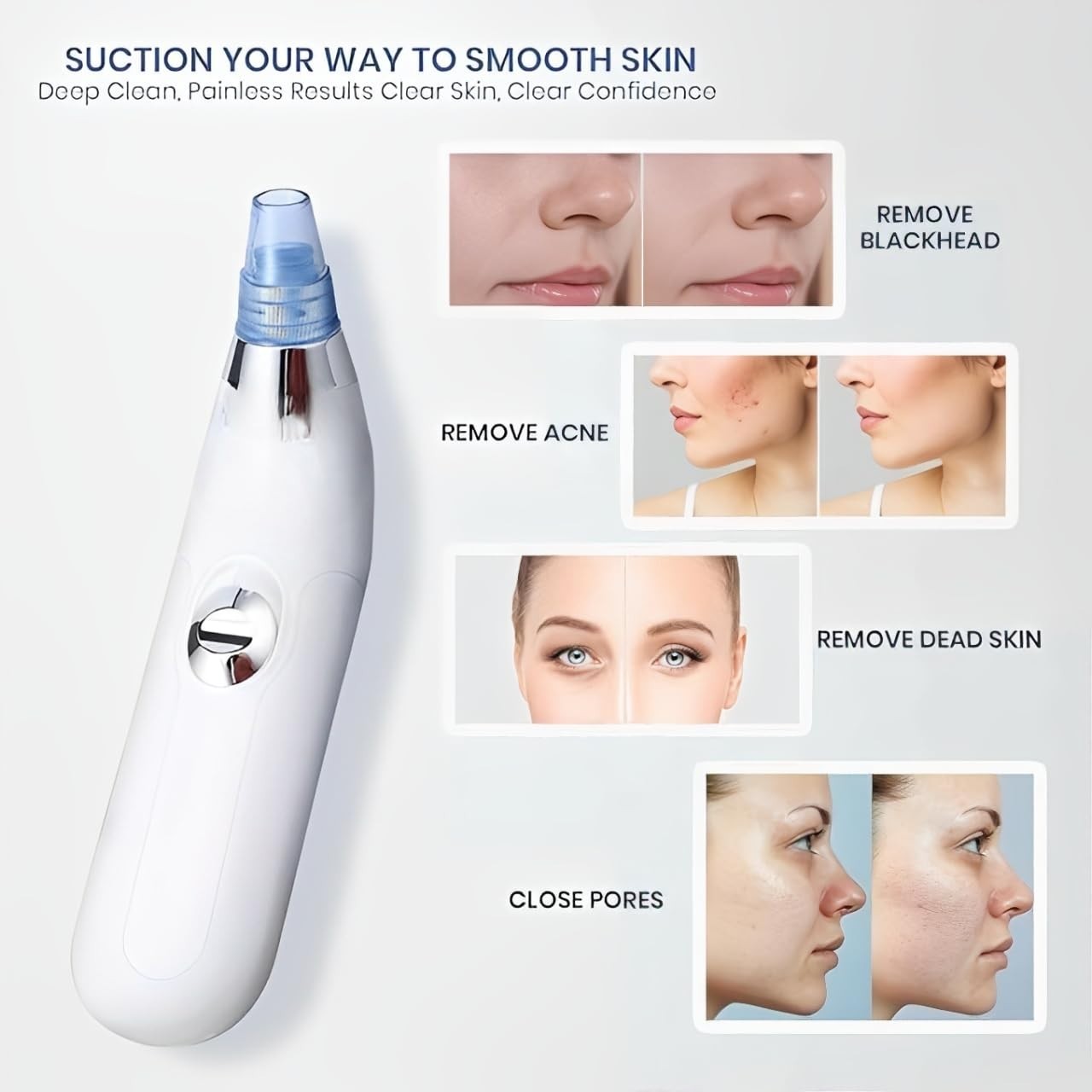 4-in-1 Electric Blackhead Remover Pore Vacuum Suction | Face Cleaner | FS USA