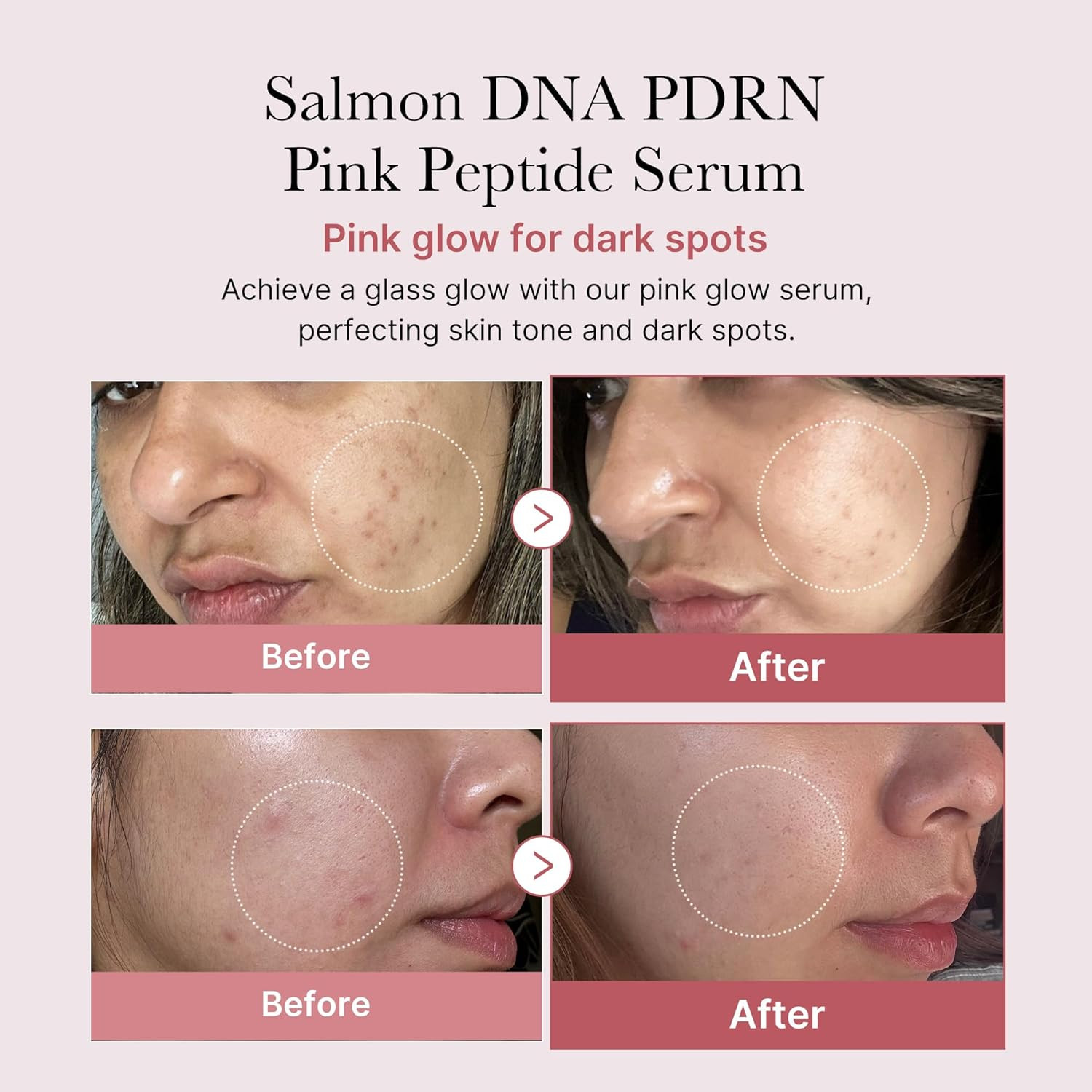 for All Skin Types Duo: Zero Pore Pads 2.0 and Salmon DNA PDRN Pink Peptide Ser