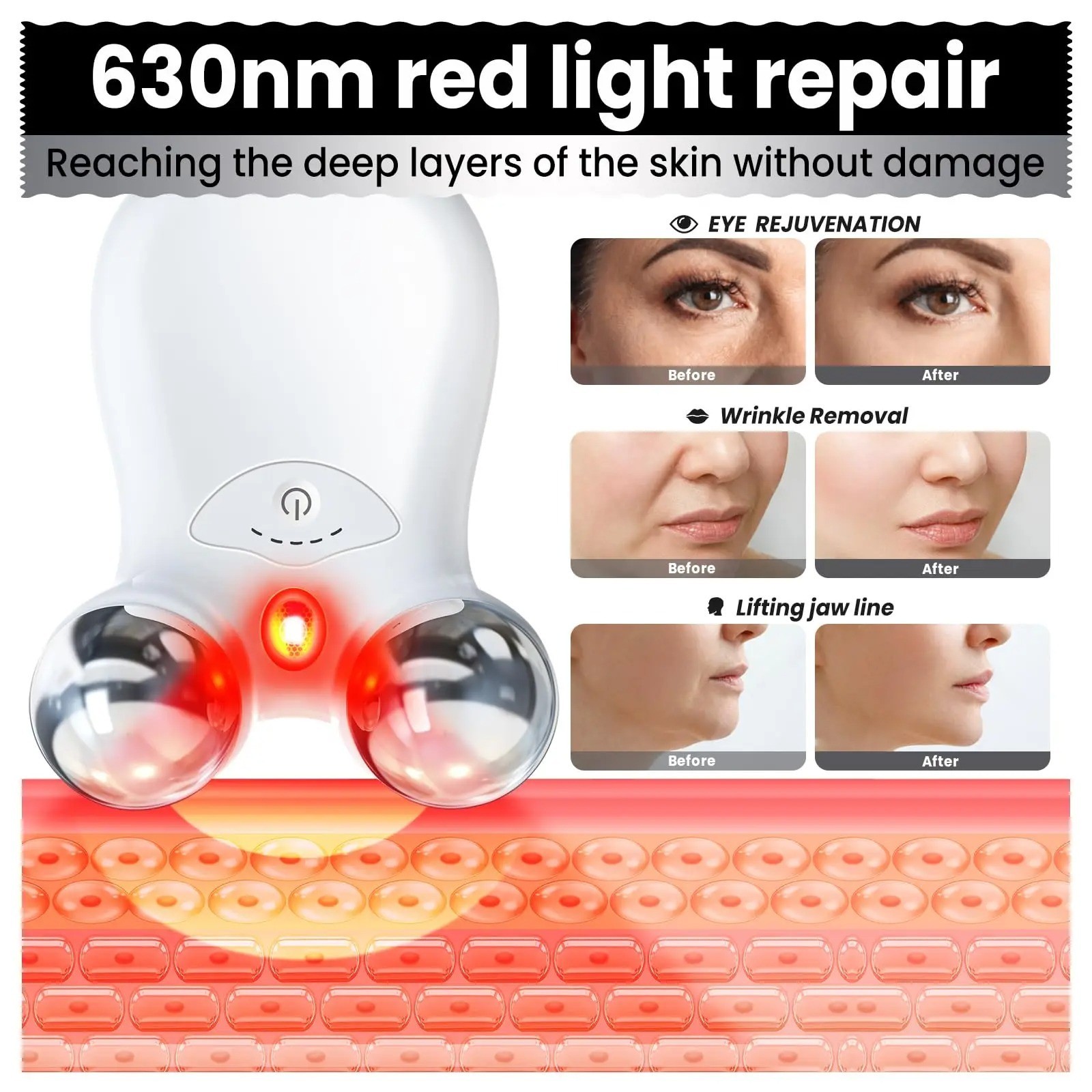 microcurrent facial device, “face lifting device