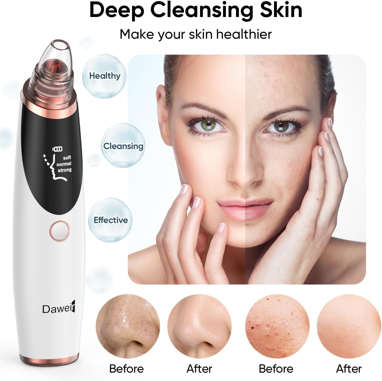 Blackhead Remover, Vacuum Suction Facial Pore Cleanser, Acne & Comedones cleaner