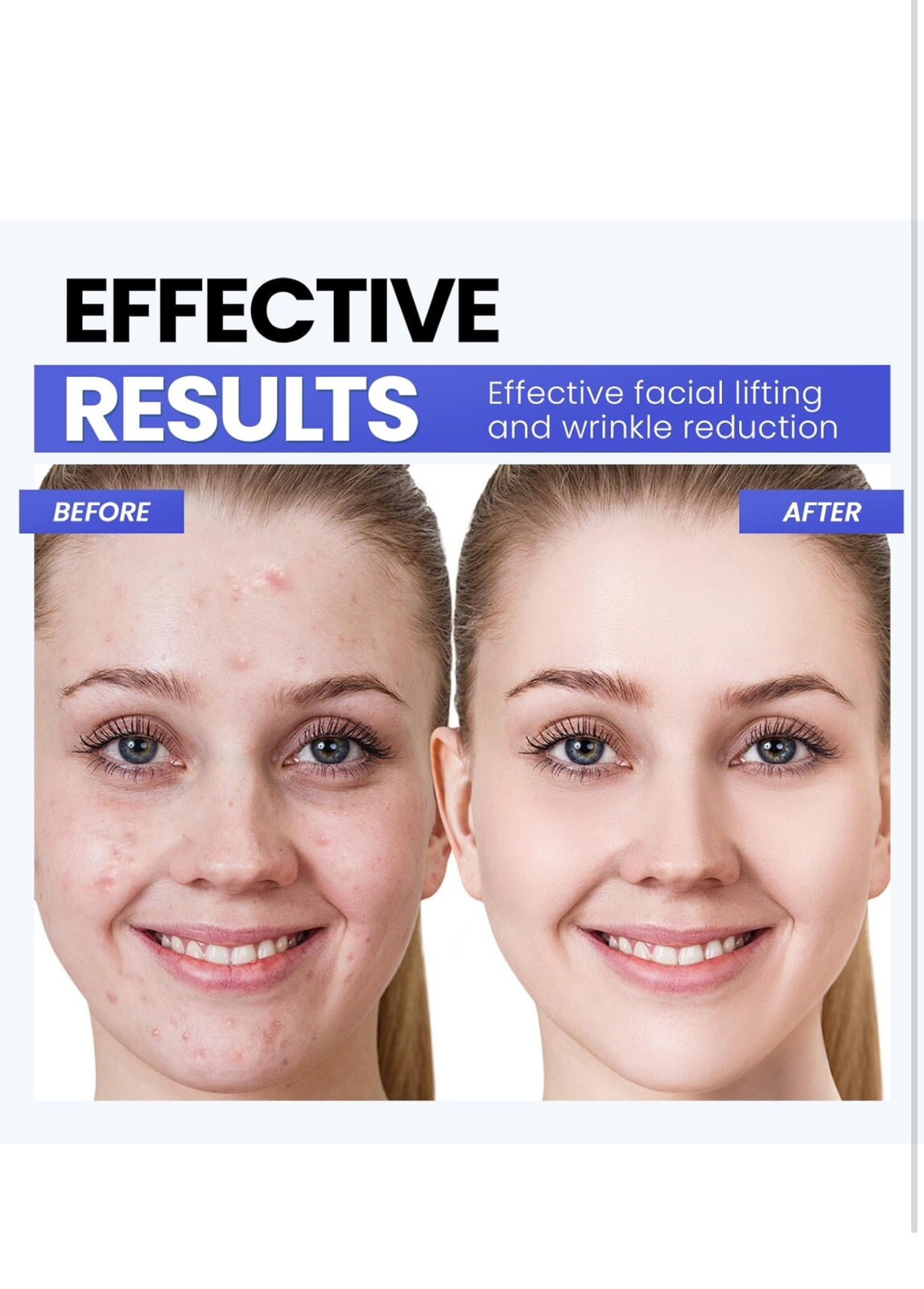 Microcurrent Facial Device,Latest Red Light Technology,Enhances The Ability to L