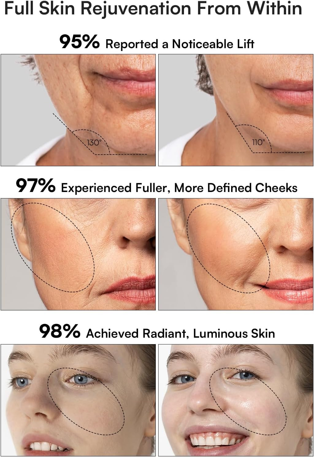 Youthful Glow 3-in-1 Micro-Current Facial Device for Wrinkle & Puffiness Relief