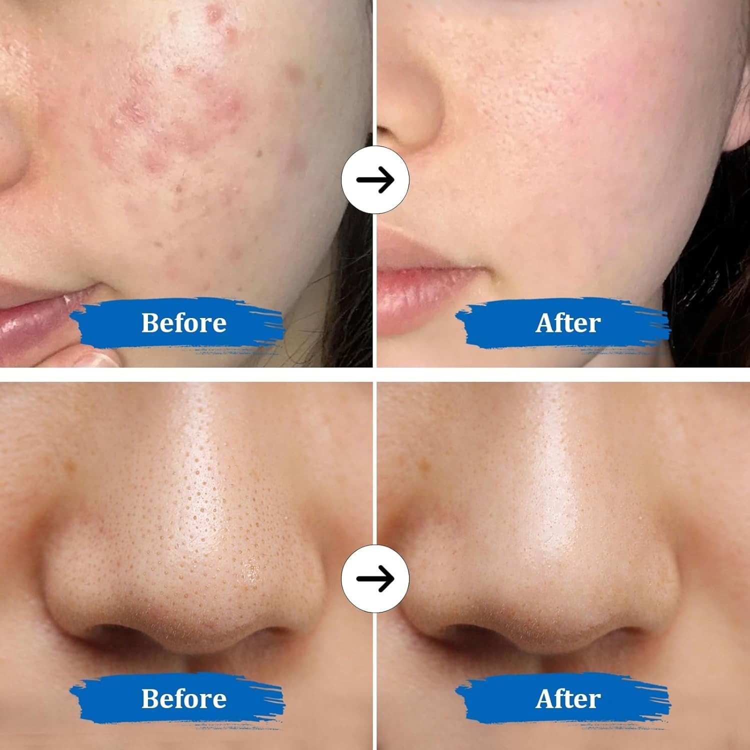 4-in-1 Waterproof Skin Scrubber: Deep Cleansing Facelift for All Skin Types