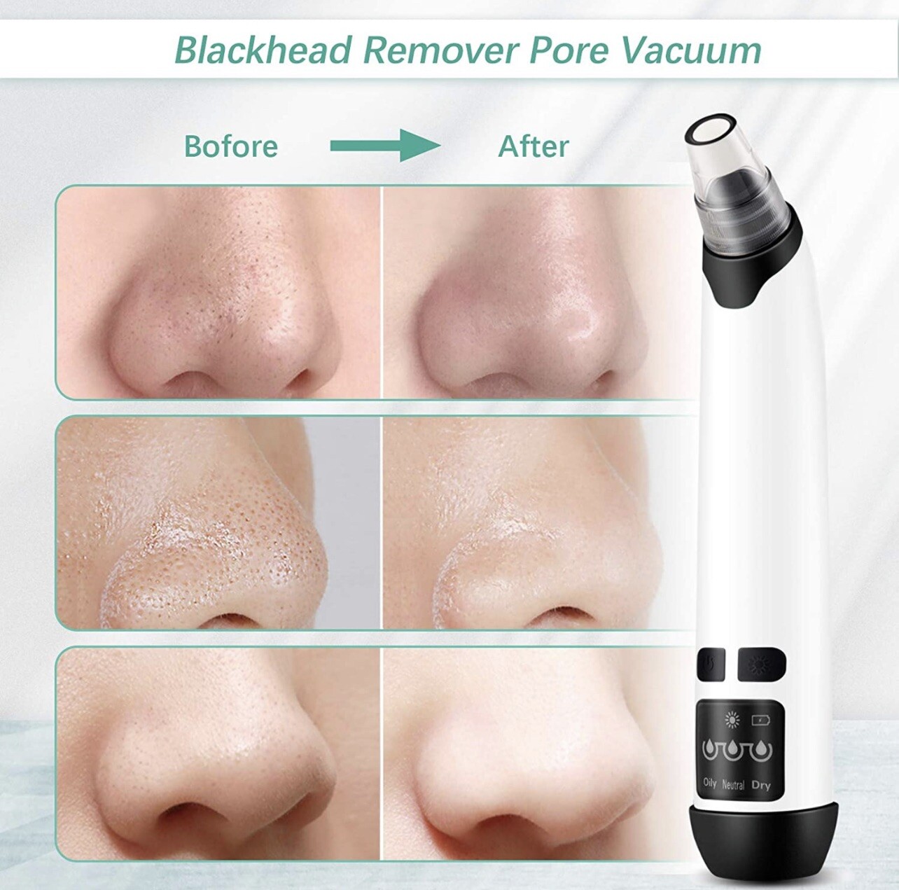 Electric Blackhead Pore Vacuum Cleaner Remover