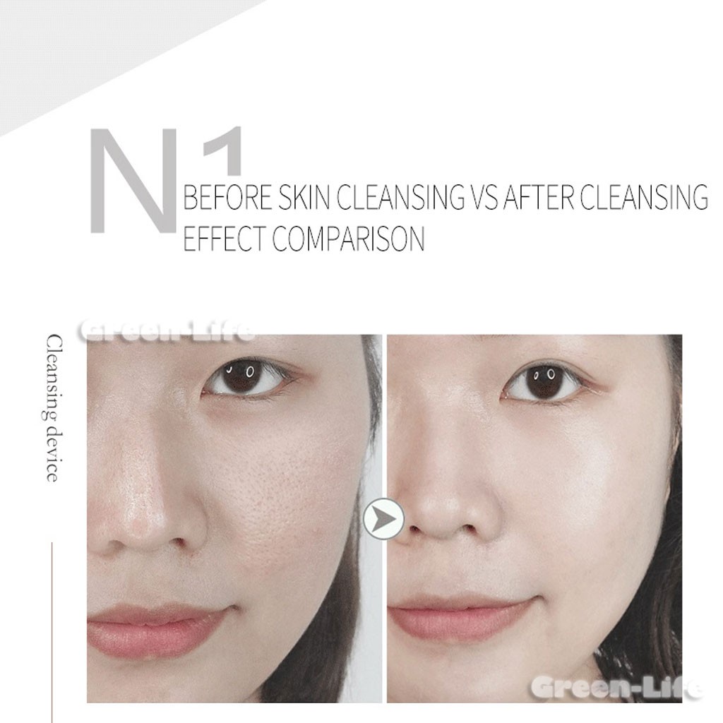 Magic Oxygen Bubble Machine Skin Cleaning Beauty Salon Facial Deep Clean Tender
