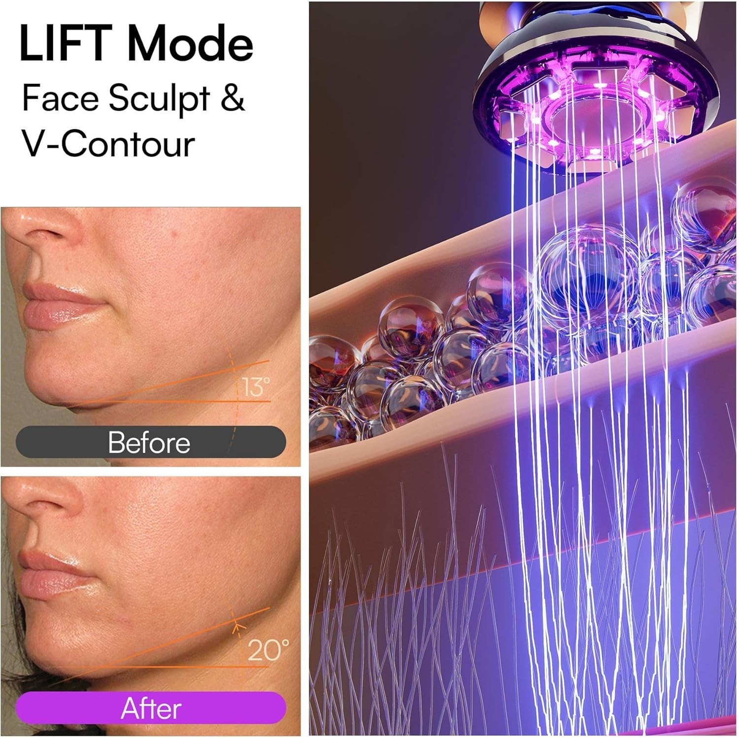 Youthful Radiance: Flare 3-in-1 Facial Device with LIFT, TIGHTEN & INFUSE Modes