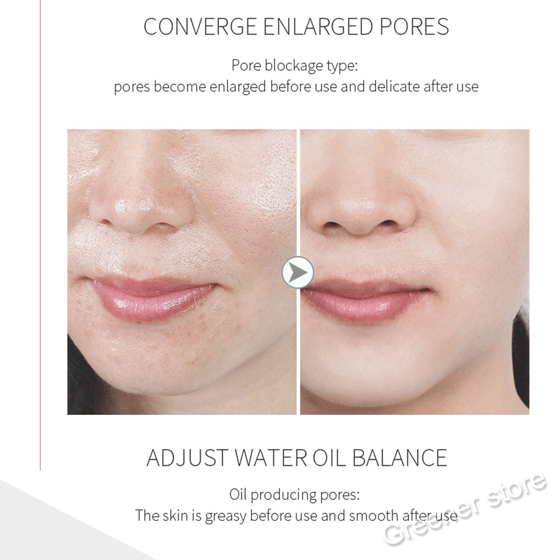 Oxygen Bubble Beauty Facial Deep Cleaning Face Rejuvenation Cleanser Machine