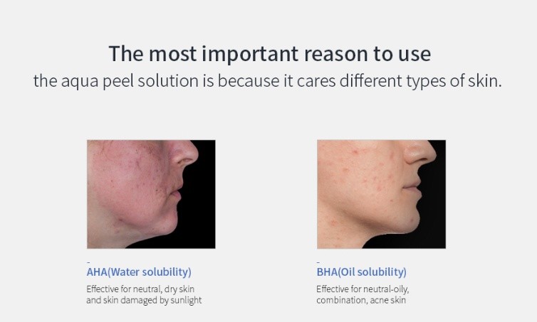 ABELUNA / Aqua Peeling Machine Home Care Skin Beauty / skin care / home care