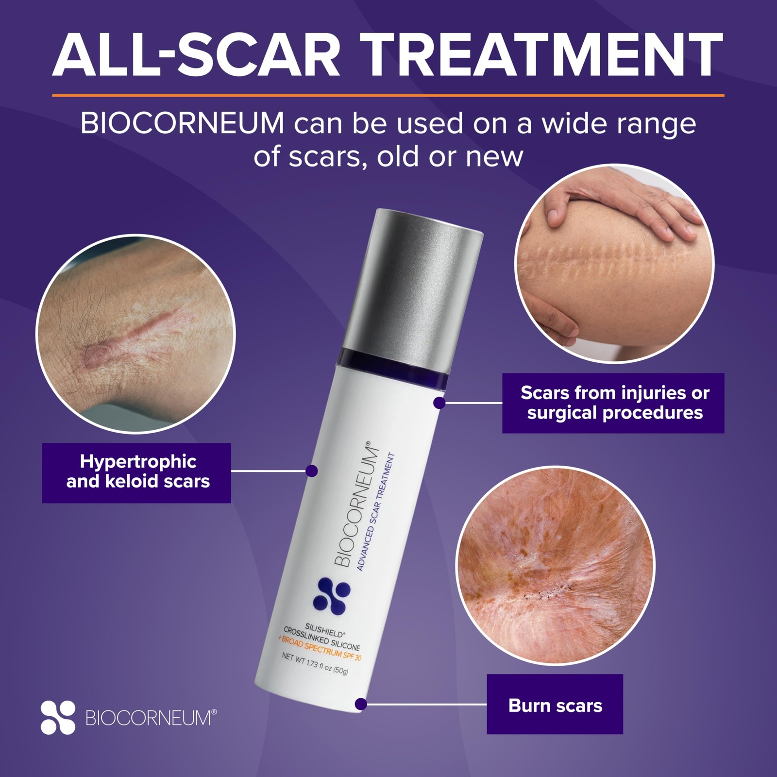 Advanced Scar Treatment with Silishield® & SPF 0.69 Ounce (Pack of 1), white