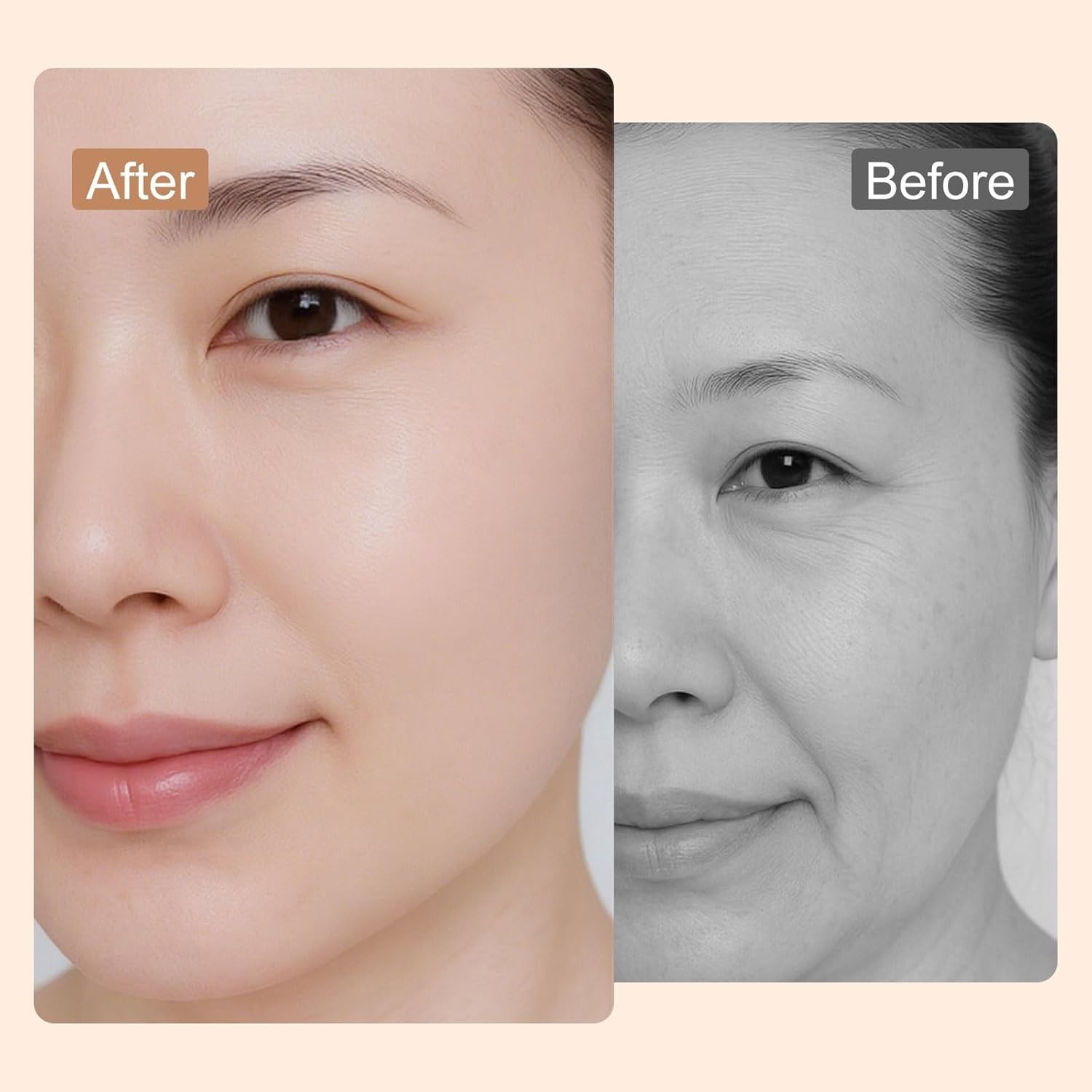 2026 Upgraded Lymphatic Dermatology Facial Brush