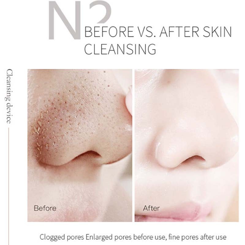 Portable Hydrodermabrasion Face Care Black Head Removal Aqual Peeling Device