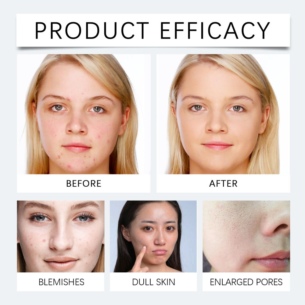 ntle Fo Cleanser Cleansing Facial Skin Hydrating