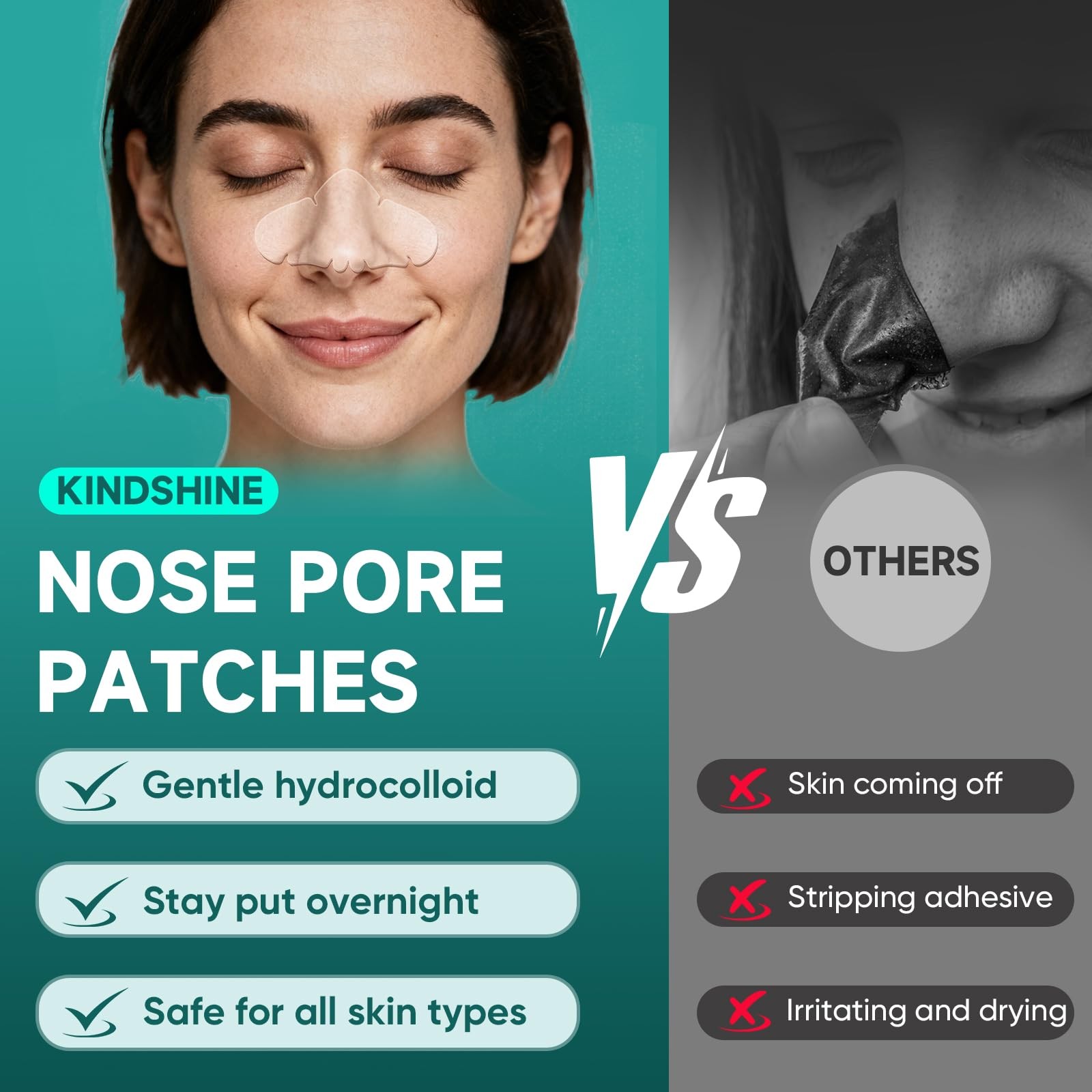 kindshine 30 Count Nose Pore Patches, Medical-Grade 1 (Pack of 30)