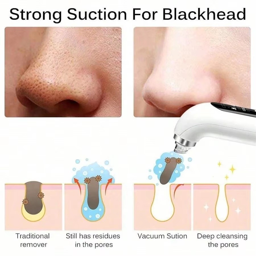 HydraClear™ Pore Vacuum – Deep Clean Blackhead Remover & Skin Purifier